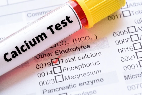What A Calcium Test Says About Your Health