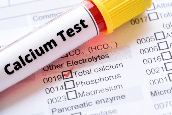 What A Calcium Test Says About Your Health? What A Calcium Test Says About Your Health